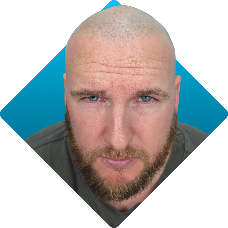Stress hair loss result
